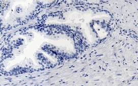 Anti-FGF-2/basic FGF Antibody, clone 1K19 ZooMAb® Rabbit Monoclonal recombinant, expressed in HEK 293 cells