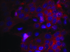 Anti-IGF1R (Ab-1161) antibody produced in rabbit affinity isolated antibody