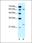 Anti-RORA antibody produced in rabbit affinity isolated antibody
