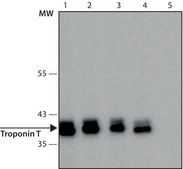 抗 肌钙蛋白 T 抗体，小鼠单克隆 clone JLT-12, purified from hybridoma cell culture