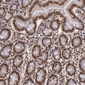 抗 SP1 兔抗 Ab1, Prestige Antibodies® Powered by Atlas Antibodies, affinity isolated antibody, buffered aqueous glycerol solution