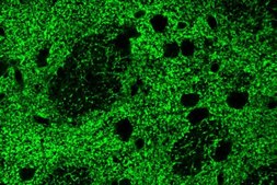 抗谷氨酸转运蛋白抗体，胶质细胞 serum, Chemicon®