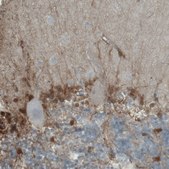 Monoclonal Anti-PHGDH antibody produced in mouse Prestige Antibodies® Powered by Atlas Antibodies, clone CL0555, purified immunoglobulin, buffered aqueous glycerol solution