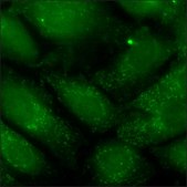 SKOV3 Cells GFP-STAT3