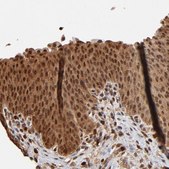 Anti-CASP1 antibody produced in rabbit Prestige Antibodies® Powered by Atlas Antibodies, affinity isolated antibody, buffered aqueous glycerol solution