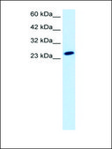 Anti-TBPL1 antibody produced in rabbit IgG fraction of antiserum