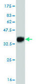 Monoclonal Anti-SGK2 antibody produced in mouse clone 3D2, purified immunoglobulin, buffered aqueous solution