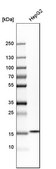 Anti-ACP1 antibody produced in rabbit Prestige Antibodies® Powered by Atlas Antibodies, affinity isolated antibody, buffered aqueous glycerol solution