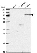 Anti-NOM1 antibody produced in rabbit Prestige Antibodies® Powered by Atlas Antibodies, affinity isolated antibody