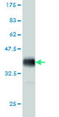 Monoclonal Anti-HDAC6 antibody produced in mouse clone 1E2, purified immunoglobulin, buffered aqueous solution