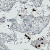 Monoclonal Anti-MMP9 antibody produced in mouse Prestige Antibodies® Powered by Atlas Antibodies, clone CL0539, purified immunoglobulin, buffered aqueous glycerol solution