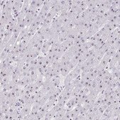 Anti-HIRA antibody produced in rabbit Prestige Antibodies® Powered by Atlas Antibodies, affinity isolated antibody, buffered aqueous glycerol solution