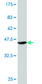 Monoclonal Anti-ALDH2 antibody produced in mouse clone 1E5, purified immunoglobulin, buffered aqueous solution