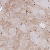 Anti-PLD1 antibody produced in rabbit Prestige Antibodies® Powered by Atlas Antibodies, affinity isolated antibody, buffered aqueous glycerol solution