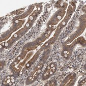 Anti-NECTIN1 antibody produced in rabbit Prestige Antibodies® Powered by Atlas Antibodies, affinity isolated antibody, buffered aqueous glycerol solution