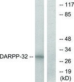 Anti-DARPP-32, N-Terminal antibody produced in rabbit affinity isolated antibody