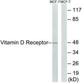 Anti-Vitamin D Receptor antibody produced in rabbit affinity isolated antibody