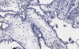 Anti-Integrin α-5 Antibody, clone 5E18 ZooMAb® Rabbit Monoclonal recombinant, expressed in HEK 293 cells