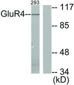 Anti-MGLUR4 antibody produced in rabbit affinity isolated antibody