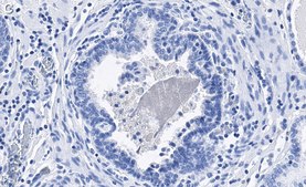 Anti-phospho-eIF-2α-Ser51 Antibody, clone 4N22 ZooMAb® Rabbit Monoclonal recombinant, expressed in HEK 293 cells