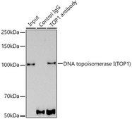 Anti-DNA topoisomerase I (TOP1) Antibody, clone 3D4W6, Rabbit Monoclonal