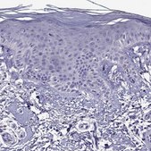 Anti-NKX3-1 Prestige Antibodies® Powered by Atlas Antibodies, affinity isolated antibody