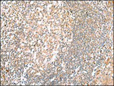 抗-HTR2A affinity isolated antibody