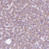 Anti-APOE antibody produced in rabbit Prestige Antibodies® Powered by Atlas Antibodies, affinity isolated antibody, buffered aqueous glycerol solution