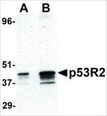 Anti-P53R2 antibody produced in rabbit affinity isolated antibody, buffered aqueous solution