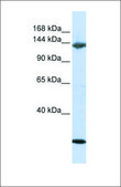 Anti-JAG2 antibody produced in rabbit affinity isolated antibody