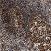 Anti-PLCG2 antibody produced in rabbit Prestige Antibodies® Powered by Atlas Antibodies, affinity isolated antibody, buffered aqueous glycerol solution, Ab1