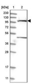 Anti-SLC9A2 antibody produced in rabbit Prestige Antibodies® Powered by Atlas Antibodies, affinity isolated antibody, buffered aqueous glycerol solution