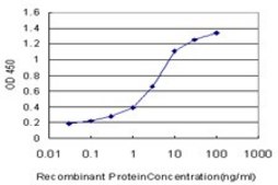 Monoclonal Anti-QPCT antibody produced in mouse clone 4E11, purified immunoglobulin, buffered aqueous solution