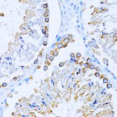 Anti-CD63 antibody produced in rabbit