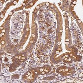 Anti-EEF1A1 antibody produced in rabbit Prestige Antibodies® Powered by Atlas Antibodies, affinity isolated antibody, buffered aqueous glycerol solution