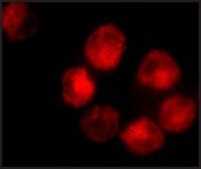 Anti-ADAM10 antibody produced in rabbit IgG fraction of antiserum, buffered aqueous solution
