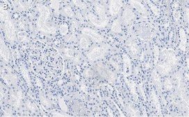 Anti-Angiotensinogen Antibody, clone 1B12 ZooMAb® Rabbit Monoclonal recombinant, expressed in HEK 293 cells