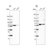 Anti-SERPINA1 antibody produced in rabbit Prestige Antibodies® Powered by Atlas Antibodies, affinity isolated antibody, buffered aqueous glycerol solution