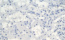 Anti-Spectrin α Antibody, clone 1D4 ZooMAb® Rabbit Monoclonal recombinant, expressed in HEK 293 cells