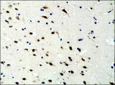 Anti-ATG4B antibody produced in rabbit IgG fraction of antiserum, buffered aqueous solution