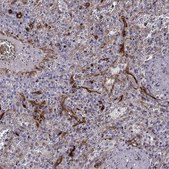 Anti-SLC9A3R2 Prestige Antibodies® Powered by Atlas Antibodies, affinity isolated antibody