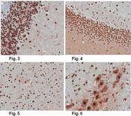 抗-Brn-2 （POU3F2）抗体，克隆8C4.2 clone 8C4.2, from mouse