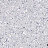 Anti-ADAM2 antibody produced in rabbit Prestige Antibodies® Powered by Atlas Antibodies, affinity isolated antibody, buffered aqueous glycerol solution, Ab1