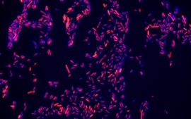 Escherichia coli FISH probe - Cy3 Probe for fluorescence in situ hybridization (FISH)