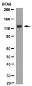 Anti-ROR2 Antibody, clone Nt 2535-2835 clone Nt2535-2835, from mouse