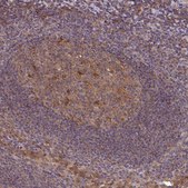 Anti-TIGAR antibody produced in rabbit Prestige Antibodies® Powered by Atlas Antibodies, affinity isolated antibody, buffered aqueous glycerol solution