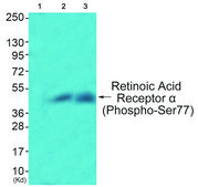Anti-Retinoic Acid Receptor A (Phospho-SER77) affinity isolated antibody