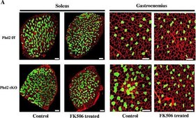 Monoclonal Anti-Myosin (Skeletal, Slow) antibody produced in mouse clone NOQ7.5.4D, ascites fluid