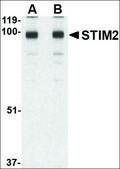 Anti-STIM2 (ab1) antibody produced in rabbit affinity isolated antibody, buffered aqueous solution
