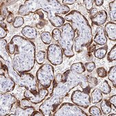Anti-EBI3 antibody produced in rabbit Prestige Antibodies® Powered by Atlas Antibodies, affinity isolated antibody, buffered aqueous glycerol solution